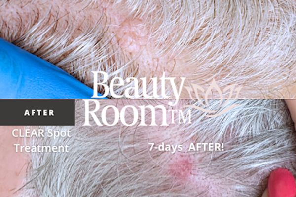 Clean, professional medical spa treatment room with neutral tones at Beauty Room TM in Hilton Head