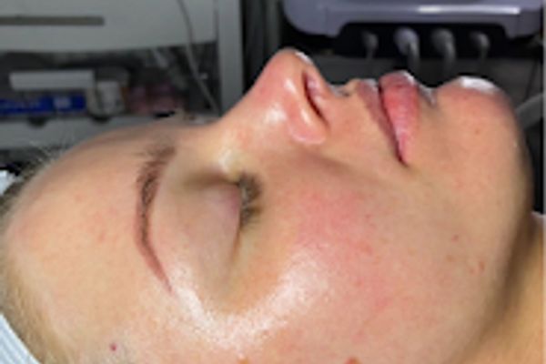 Clean, professional medical spa treatment room with neutral tones at Sculptress LLC in Ogden